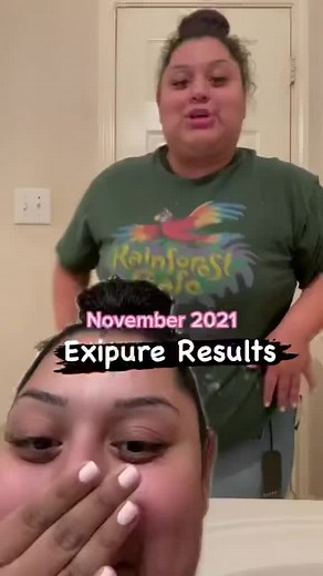 exipure before and after #exipure #weightlosstransformation #techiteasy #learnontiktok#vlog #multiverseofmadness #tiktokarabgamer #tiktoksalon