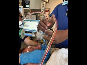 Pulmonary alveolar proteinosis | full lung lavage | surgery video | video 3