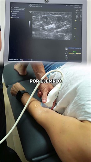 Cómo localizar el nervio mediano con ecografía | Fisioterapia