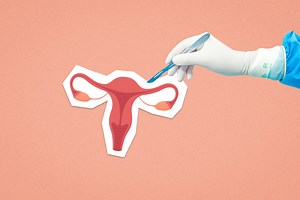 It’s a Surgery That’s Often Viewed as a Tragedy. For Many, It’s Actually a Wonderful Choice.