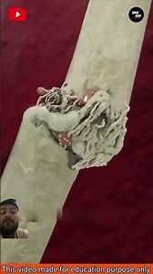 Whts do if ure bone break#shortsfeed #shortsviral #shortsvideo