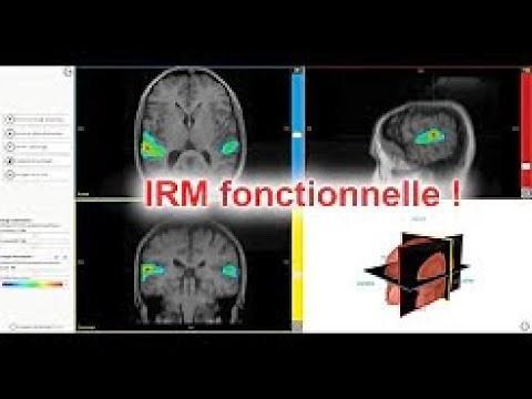 fMRI and EduAnat2: correctly interpreting a functional MRI – pitfalls to avoid