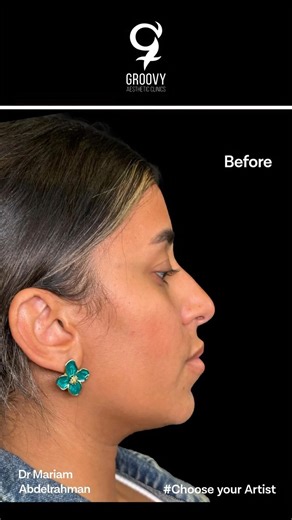 7.7K views · 12 reactions | When harmony brings every feature...