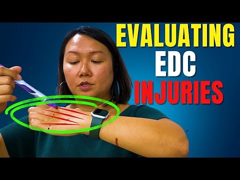 Evaluating The EDC Ligament (Extensor Digitorum Communis) EDC Injuries.
