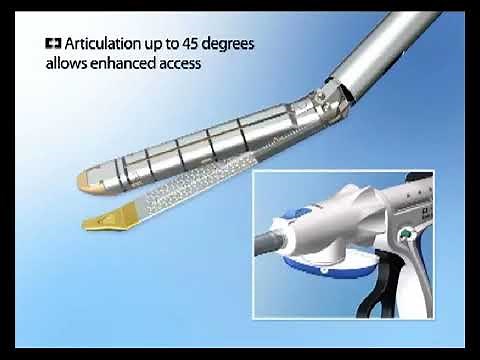 Endo GIA™ Curved Tip Reloads with Tri Staple™ Technology YouTube