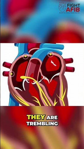 Normal Heartbeat vs AFib: What's Actually Happening