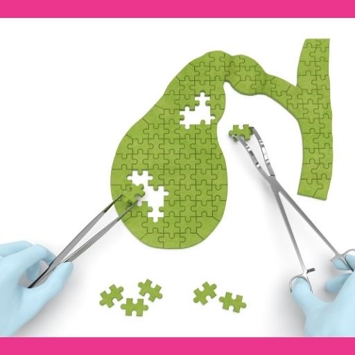 Diarrhea After Gallbladder Removal: Causes, How Long It Lasts? & Treatment. - Oh My Gut