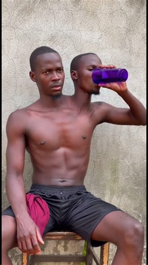 Don't Believe What They Say About Conjoined Twins in Africa #shorts #viral