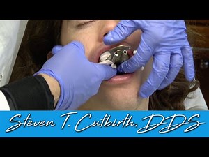 Dental Assisting - How to Take Alginate Impressions • Video • MEDtube.net