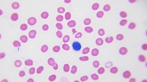 Rbc Wbc Under Microscope Hq Video Stock Footage Video (100% Royalty-free) 1110172569 | Shutterstock