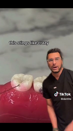 How to Remove Teeth at Home: Easy DIY Methods