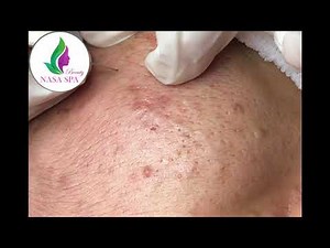 Nasa SPA #02 Satisfying relaxing acne new 2021.