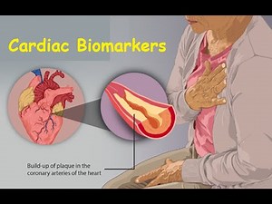 Cardiac Markers