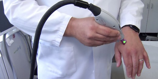 Dermatologists uncover laser treatment for port wine stain birthmarks