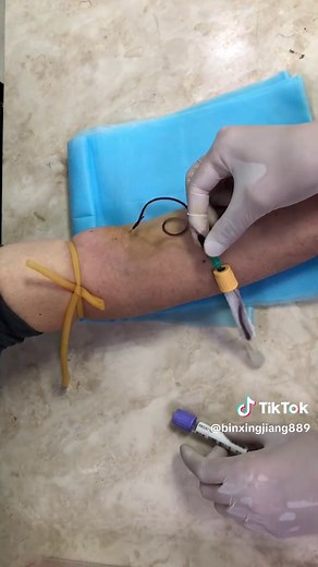 The Role of a Phlebotomist in Blood Collection