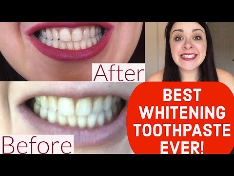 BEST WHITENING TOOTHPASTE EVER: REVIEW Crest 3D White Brilliance