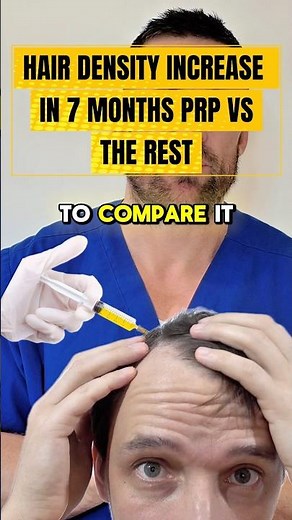 PRP vs Minoxidil & Finasteride 7-month hair density comparison #hair #finasteride #Minoxidil #PRP