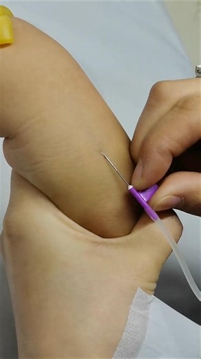 The Ultimate Guide to Injection Techniques (Step-by-Step)#Shorts #trending #shortsfeed #injection