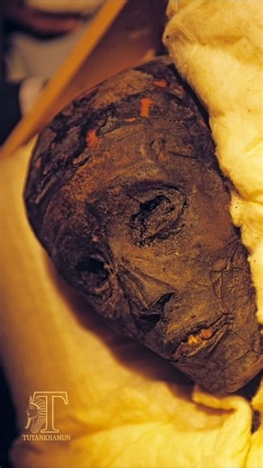 A Face That Defied Time.. 3,300 Years of Silence! 🏺✨ Have you ever paused to truly look into the eyes of the Boy King, Tutankhamun? 👑 This isn't just a photograph of a mummy; it’s a window into the life of one of Ancient Egypt’s most mysterious and debated rulers. Despite the passage of millennia, his features still hold a haunting majesty—from the clarity of his teeth to his skin, preserved by the incredible mastery of ancient Egyptian embalmers. Quick Facts About the Face Behind the Mask: Ag