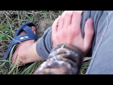 Removing Burrs from Clothing