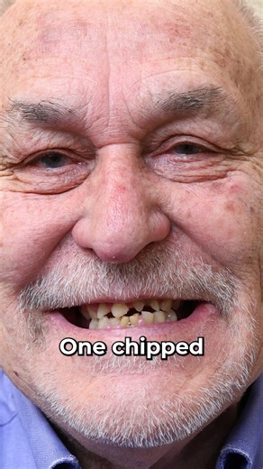 7.2K views · 13 reactions | One chipped tooth affected his eating forever... 﫢醴 Have you ever faced a small dental issue that had a big impact on your life? Discover his story and learn how he overcame this challenge to enjoy eating again.  #dentalimplants #dental #fyp #newlife #smilemakeover #smile #foodie #Confidence | Nuvia Dental Implant Center | Facebook