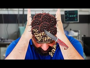 ASMR Animation Treatment Removal Insects, Worms & Pustules Cleaning From Man Head | Deep Cleaning