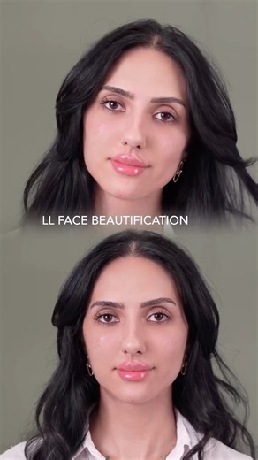 تجميل للوجه كامل full face beautification #face #full #beauty #تجميل #الوجه #كامل #ترند #دبي #تجميل