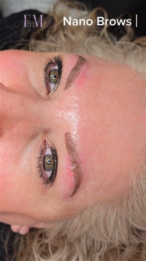 Today's Nano Brows were quite the challenge 🙃. My lovely client had over plucked her eyebrows back in the 90's (does that sound familiar to you? 😉). Now, she was left with barely any eyebrows, so we worked together to find the perfect symmetry and create a natural look with NANO BROWS. She also had a scar on her left eyebrow that was causing a slight dent. Her new eyebrows will heal in 10-14 days, looking softer and more natural. Want to see her healed results? Comment 🙌🏼 and I'll keep you u