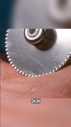 How a Cast Saw Won’t Cut Your Skin