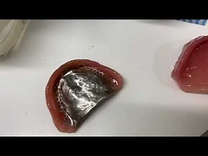 総義歯吸着(1/2)アーライン