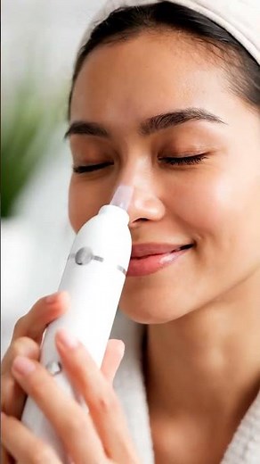 “Blackhead Vacuum Removal: Deep Pore Cleaning for Clear Skin (Satisfying Video)”