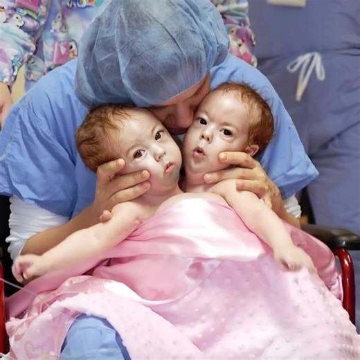 Born together but separated in a miraculous way, these conjoined twins grew up on different paths. Their reunion, years later, amazed everyone who learned about their extraordinary destiny. Born together, miraculously separated: the incredible story of these adorable conjoined twin girls 😮💖🌟 Abby and Isabelle, the famous conjoined twins who captured the hearts of millions after their groundbreaking separation surgery in 2006, have lived an almost magical journey ✨💫. From birth, they were ins