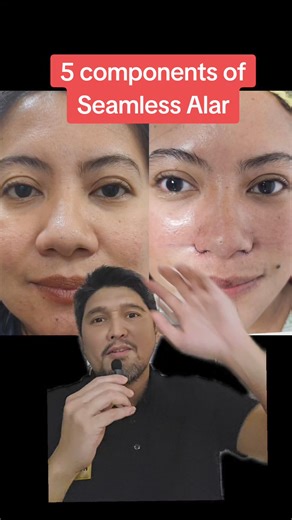 69K views · 732 reactions | 5 components of seamless alar 1. Alar lifting 2. Alar base reduction 3. Alar narrowing 4. Meticulous suturing 5. Alar bunching sutures | Clara V Clinic | Facebook