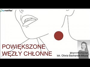 POWIĘKSZONE WĘZŁY CHŁONNE