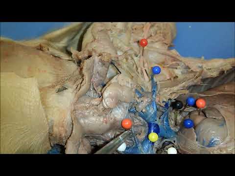 Fetal Pig Cardiovascular System Dissection for A&P lab