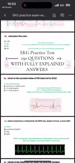 250 EKG Questions and Answers