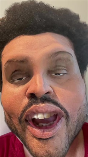 The Weeknd Plastic Surgery Transformation: What Really Happened?