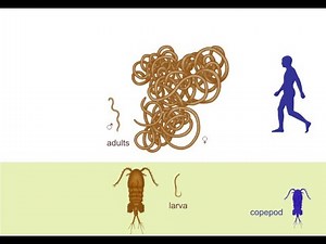 Dracunculus Medinensis (Guinea Worm) Causing Dracunculiasis ; Symptoms, Diagnosis, Treatment