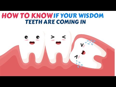 Signs of Wisdom Teeth Coming in (8 Symptoms to Look for)