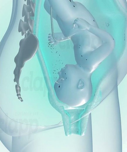 precious moments of Child birth (3D Animation)