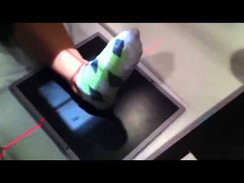 Xray - Ankle Stress Study