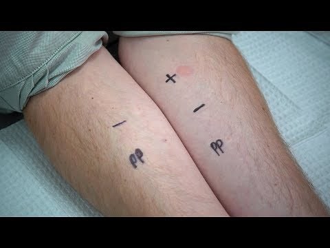 Penicillin Allergy: Evaluation and Testing