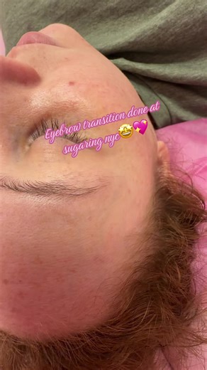 Eyebrow Transformation Using Sugaring Technique
