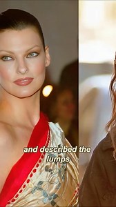 494K views · 608 reactions | 5 celebrities whose careers were ruined by plastic surgery #celebrity #fyp #actor #women #actor #celebrities | Applefrog | Facebook