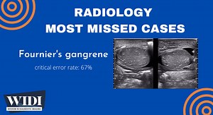 Most Missed Case: Fournier’s Gangrene »  Wisdom in Diagnostic Imaging » College of Medicine » University of Florida