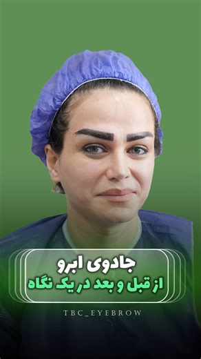 ‎کاشت ابرو | کاشت ابروی طبیعی‎ on Instagram‎: "⁨ ⁨ کاشت ابرو نچرال😍👇🏻 . 📌 در کاشت ابرو ، طبیعی بودن و اندازه درست تراکم بسیار مهمه که متخصصین کلینیک تهران بیوتی سنتر با تجربه ۳۰ هزار عمل موفق بهترین و طبیعی ترین کاشت رو‌ با ضمانت نامه برای شما انجام میدن ✅ با یک کاشت ابرو پر تراکم در کلینیک معتبر شما تا همیشه ابروهای پُر و زیبا خواهید داشت اونم طبیعی😎 ✅ بدون جراحی به صورت تار به تار با تراکم بالا و‌ خواب طبیعی ✅ همچنین طراحی قبل از کاشت ‌متناسب با سلیقه ‌‌و فرم صورت شما انجام میشه ✅ با یک پ