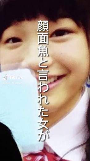離れ目、魚顔、団子鼻の私が必死に垢抜け頑張った結果。同一人物？整形？と疑われる今😌努力で何とでもなるって私が証明する！女の子の可能性は無限大！#垢抜け #垢抜けたい #垢抜け方法 #垢抜け隊 #ダイエット #ダイエット法 #ダイエッター #ビフォーアフター#黒歴史