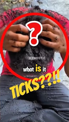 Covered in TICKS?! This Will Make You Itch 😂😱