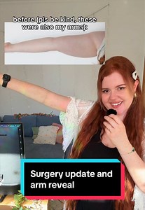 Another one to add to my collection #lipedema #chronicillness #surgery #liposuction #endometriosis