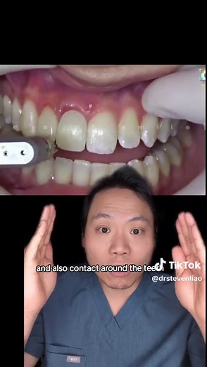 Making a Temporary Crown at Home: Dental Tips